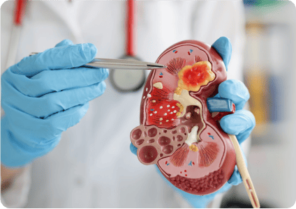 kidney check inodaya hospital