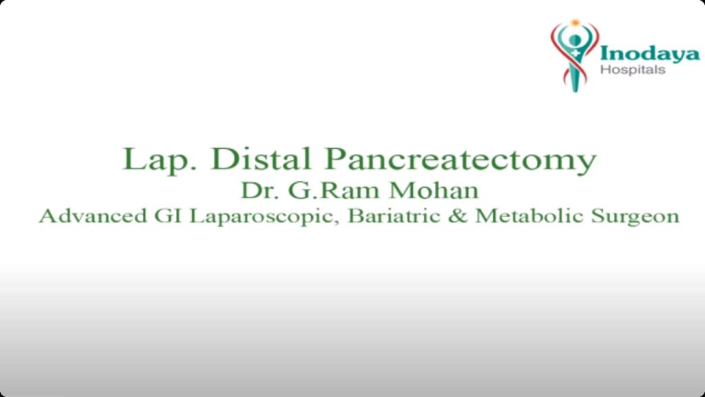 Distal Pancreatectomy in Kakinada