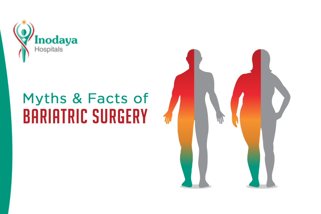 Inodaya-bariatric-surgery-thumbnail-1