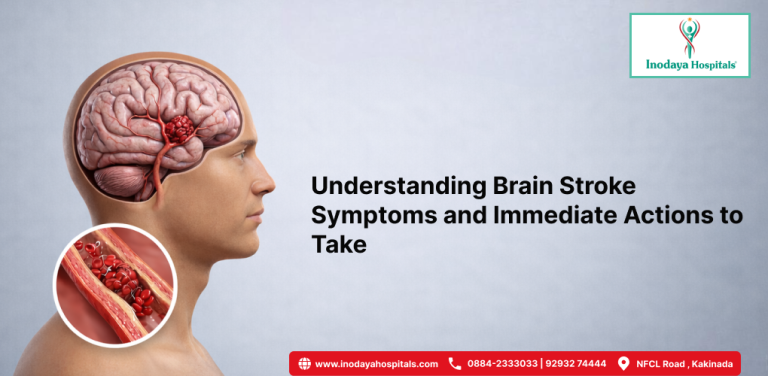 Understanding Brain Stroke Symptoms and Immediate Actions to Take