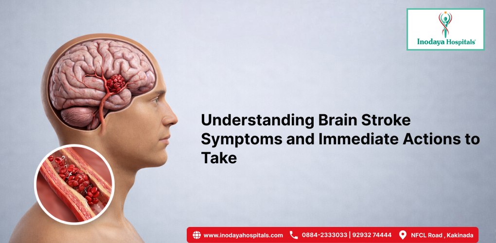 Understanding Brain Stroke Symptoms and Immediate Actions to Take
